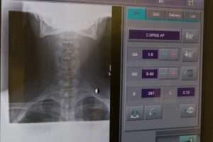 A digital neck X-ray