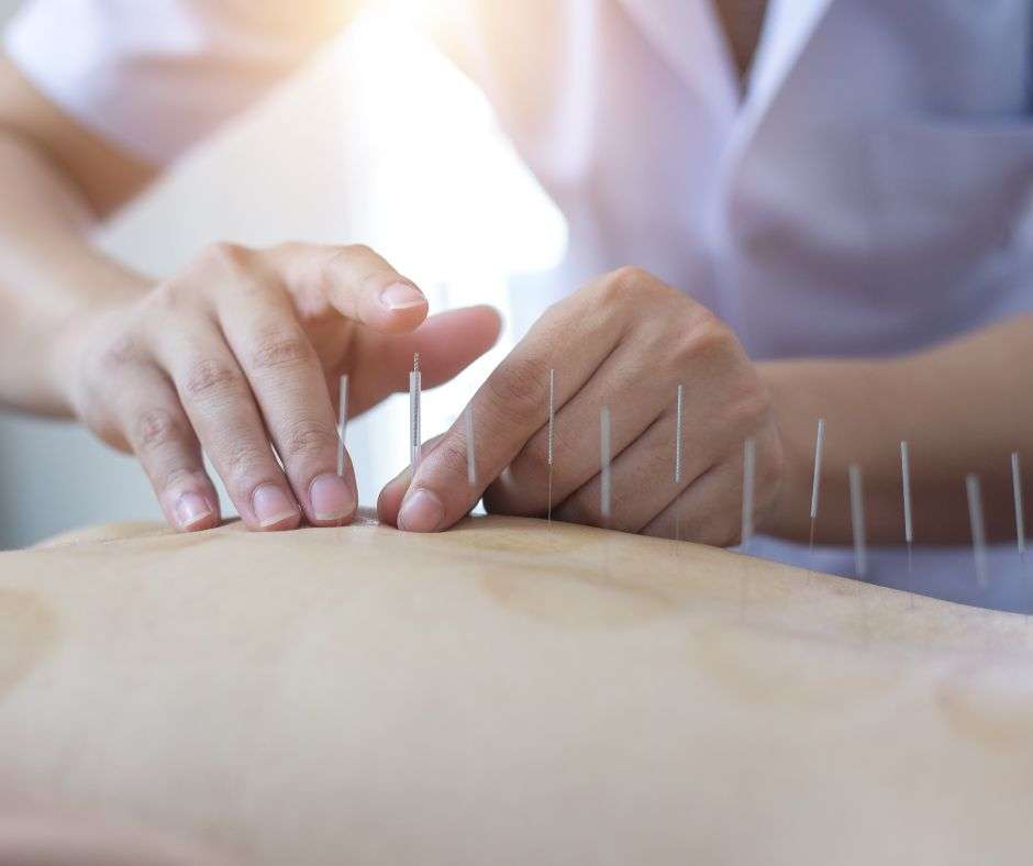 Acupuncture Van Nuys Healthline Medical Group
